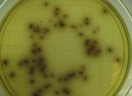 Listeria monocytogenes grown on Listeria Selective Agar