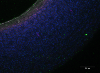 Alfalfa seedlings inoculated with E. coli O157:H7 (c) James Hutton Institute