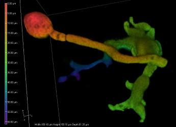 Initial penetration of a leaf by P. infestans 