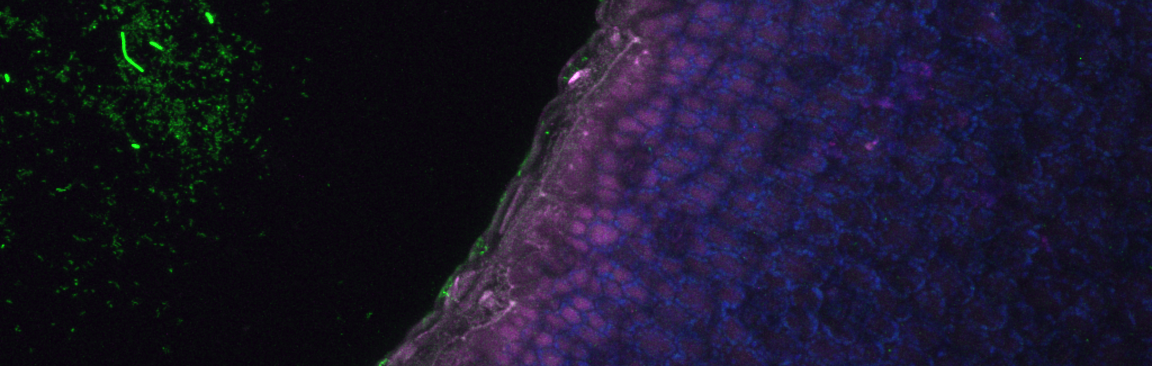 Alfalfa seedlings inoculated with E. coli O157:H7 (c) James Hutton Institute