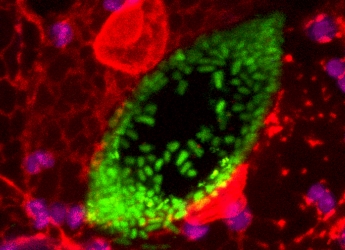 E coli (c) James Hutton Institute